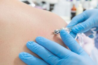 Doctor examining skin in a clinical setting.